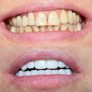 Slider image (8) Jose Alonso DDS